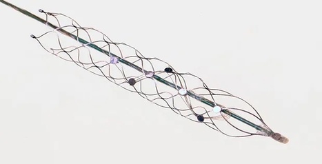 Synchron secures funding to advance commercialisation of Stentrode | Neurovascular Intervention | Scoop.it