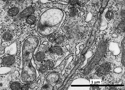 Quand des parasites du sexe influencent le microbiote  | EntomoNews | Scoop.it