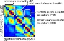 Arithmetic success and gender-based characterization of brain connectivity across EEG bands | ED 262 mylineONLINE:  Gender, Sexism, & Sexual Orientations | Scoop.it