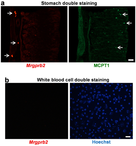 Identification of a mast-cell-specific receptor crucial for pseudo-allergic drug reactions : Nature : Nature Publishing Group | Immunopathology & Immunotherapy | Scoop.it