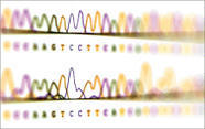 UK explores whole-genome sequencing for newborn babies - Lancet | dépistage néonatal | Scoop.it