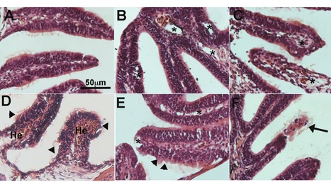A Zebrafish Model for COVID-19 Recapitulates Olfactory and Cardiovascular Pathophysiologies Caused by SARS-CoV-2 | Virus World | Scoop.it