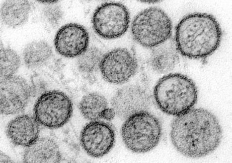Sympt&ocirc;mes, modes de contamination, espoirs pour la recherche&hellip; Huit questions sur l&rsquo;hantavirus | EntomoScience | Scoop.it