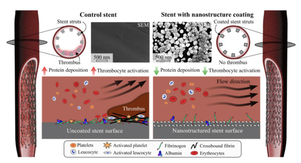 A novel noble metal stent coating reduces in vitro platelet activation and acute in vivo thrombosis formation: a blinded study | Interventional Cardiology | Scoop.it