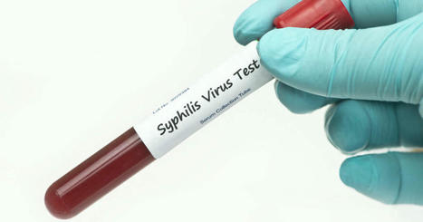 Aux États-Unis, la recrudescence des cas de syphilis s’accompagne de symptômes inhabituels | Actualités pour Hémisphères Gauche et Droit | Scoop.it