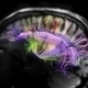 Via Slate : Le cerveau peut se soigner tout seul | Médecine  Cerveau Intelligence | Scoop.it