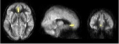 Study Finds Aerobic Exercise Improves Memory, Brain Function and Physical Fitness | Center for BrainHealth | Fitness, Health, and Wellness | Scoop.it