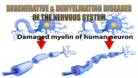 Degenerative And Demyelinating Diseases Of The Nervous System | Spine Health & Spinal Hygiene | Scoop.it