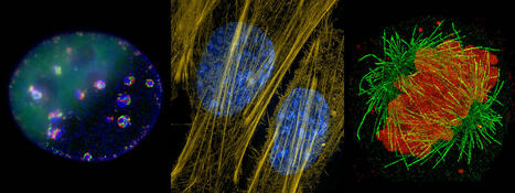 Super-resolution microscopes reveal new details of cells and disease | Knowable Magazine | Virology News | Scoop.it