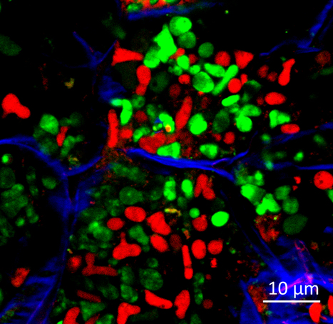 Plant endosymbionts defend themselves against the hostile host environment | I2BC Paris-Saclay | Scoop.it
