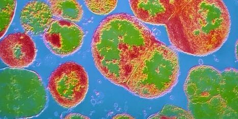 Le retour en force des infections sexuellement transmissibles | sida | Scoop.it