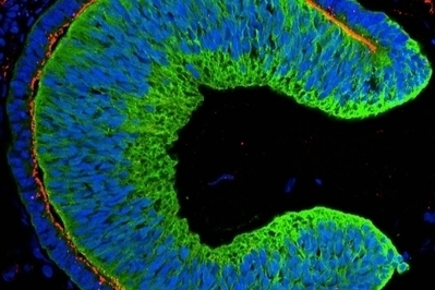 Una retina de células madre abre las puertas del trasplante | Salud Visual (Profesional) 2.0 | Scoop.it