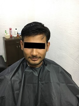 Hair Weaving Services In Ahmedabad Hair Bondin