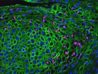 Immunohistochemistry - In Situ Hybridization - Western Blotting | Immunology for University Students | Scoop.it