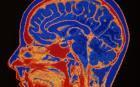 When you diet, you eat your own brain! | No Such Thing As The News | Scoop.it
