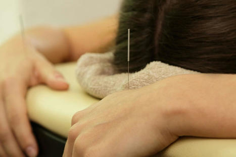 Eczema Relief: Exploring the Benefits of Acupuncture | Call: 915-850-0900 or 915-412-6677 | Functional Medicine "Advancing The Medical Health Model" | Scoop.it
