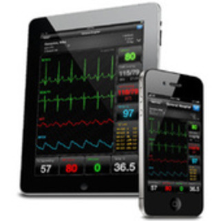 How Tomorrow's Mobile Doctors Will Monitor Your Vital Stats - Gizmodo | Patient Self Management | Scoop.it
