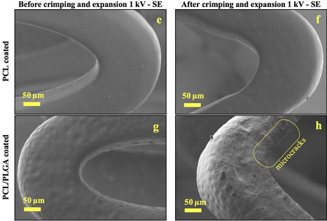 Electrochemical Impedance Spectroscopy study of a Mg-based alloy stent with layered coatings | Interventional Cardiology | Scoop.it