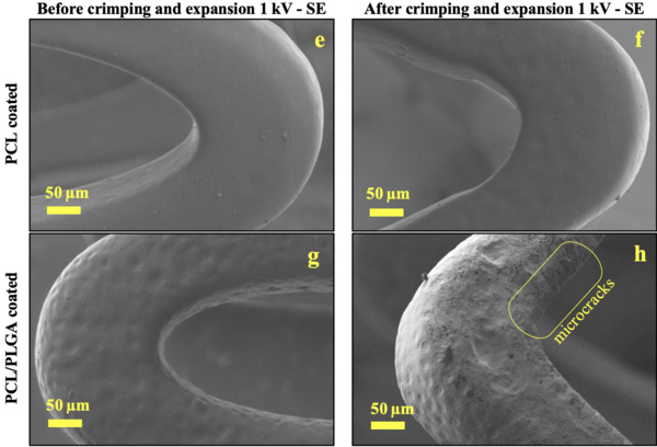 Electrochemical Impedance Spectroscopy study of a Mg-based alloy stent with layered coatings | Interventional Cardiology | Scoop.it