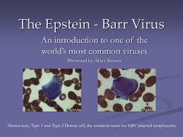 A vaccine to kiss EBV goodbye | Immunology and Biotherapies | Scoop.it