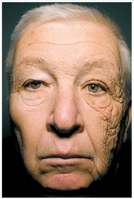 The Aging Effects of the Sun Revealed on Trucker’s Face | Science News | Scoop.it