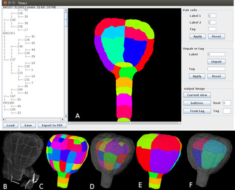 TreeJ : un plugin interactif d'ImageJ pour reconstruire un lignage cellulaire &agrave; partir d'images statiques | Life Sciences Universit&eacute; Paris-Saclay | Scoop.it