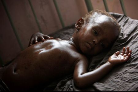 Cholera claims 67 lives in Somalia | Actualités Afrique | Scoop.it