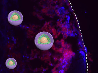 Study reveals optimal particle size for anticancer nanomedicines | 21st Century Innovative Technologies and Developments as also discoveries, curiosity ( insolite)... | Scoop.it