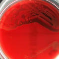 MRSA Genome Predicts Toxicity - Bioscience Technology | Genetics - GEG Tech top picks | Scoop.it