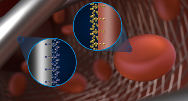 Treatment of ruptured intracranial aneurysms using the novel generation of flow-diverters with surface modification | Neurovascular Intervention | Scoop.it