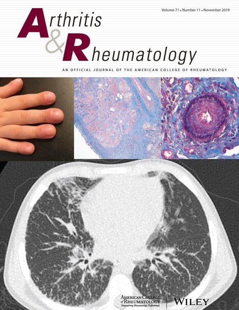 Multiparameter Analysis Identifies Heterogeneity in Knee Osteoarthritis Synovial Responses - Labinsky - - Arthritis & Rheumatology | Rheumatology-Rhumatologie | Scoop.it
