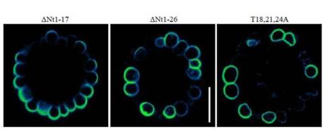 IN BRIEF: Threonine Phosphorylation Regulates Polar Localization of the Boric Acid Transporter NIP5;1 in Root Cells | The Plant Cell | Scoop.it
