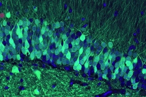 MÉMOIRE : Il sera bientôt possible de raviver des souvenirs | Science & Transhumanisme | Scoop.it