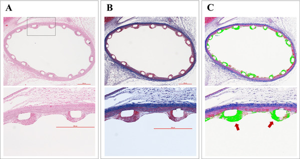 Comparisons of early vascular reactions in biodegradable and durable polymer-based drug-eluting stents in the porcine coronary artery | Interventional Cardiology | Scoop.it