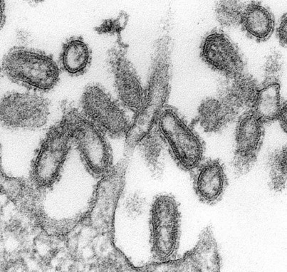 Influenza: A viral world war | Complex Insight  - Understanding our world | Scoop.it