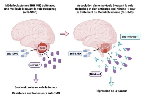 La Nétrine-1, une nouvelle cible prometteuse pour le traitement des médulloblastomes liés à une activation de la voie Sonic Hedgehog | Life Sciences Université Paris-Saclay | Scoop.it