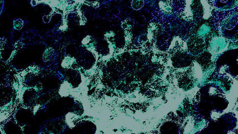 CDC early warning systems have gone dark. Here's how to fill the gap | H&eacute;sitations Vaccinales: Observatoire HESIVAXs | Scoop.it