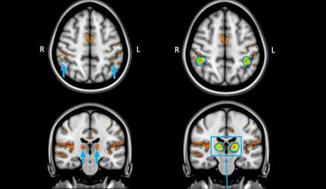 Ultrahigh-field MRI reveals how blue light stimulates thw brain: alertness, performance and cognitive aspects | HMD hot spot | Scoop.it