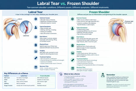 Labral Tear vs Frozen Shoulder: Key Differences, Symptoms, Causes & Treatment | Rheumatology-Rhumatologie | Scoop.it