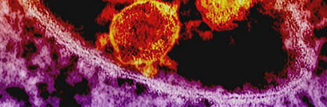 Long COVID: Update October 2024 &nbsp; &ndash; SPICe Spotlight | Solas air SPICe | In the news: data in the UK Data Service collection across the web | Scoop.it