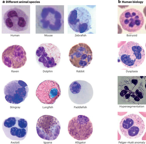 Shaping neutrophil morphology and function: the importance of a segmented nucleus | Nature Reviews Immunology | Immunology | Scoop.it