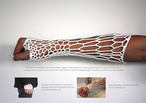 Cortex 3D-Printed Cast Improves Comfort and Reduces Waste | Healthcare: reloaded... | Scoop.it