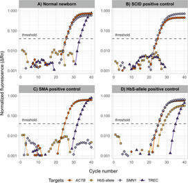 A high-throughput newborn screening approach for SCID, SMA, and SCD combining multiplex qPCR and tandem mass spectrometry | PLOS ONE | dépistage néonatal | Scoop.it