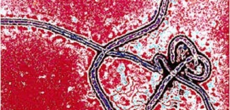 Le virus de la fièvre hémorragique n’est pas «zaïrois» ! C’est une nouvelle souche selon une étude scientifique | Toxique, soyons vigilant ! | Scoop.it