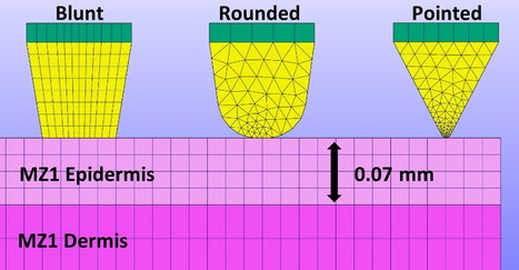 An analysis of the relationship between microneedle spacing, needle force and skin strain during the indentation phase prior to skin penetration | Intra-Dermal drug delivery: Opportunities and Challenges? | Scoop.it