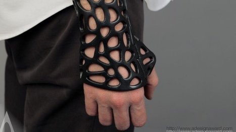 3D-printed cast concept uses ultrasound to heal broken bones | 21st Century Innovative Technologies and Developments as also discoveries, curiosity ( insolite)... | Scoop.it