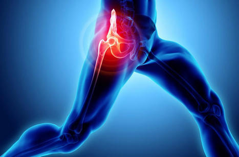 The Impact On Osteoarthritis On The Hips | Call: 915-850-0900 | Mobility & Flexibility - Joint Movement | Scoop.it