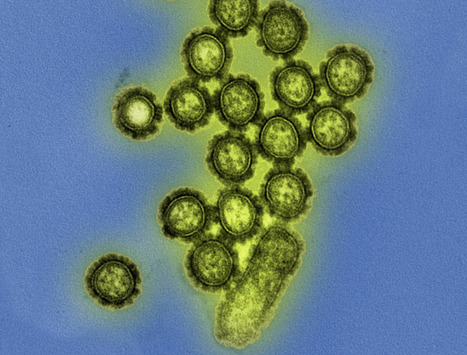NIH Starts Clinical Trial of Universal Influenza mRNA&nbsp;Vaccine Candidate | Amazing Science | Scoop.it