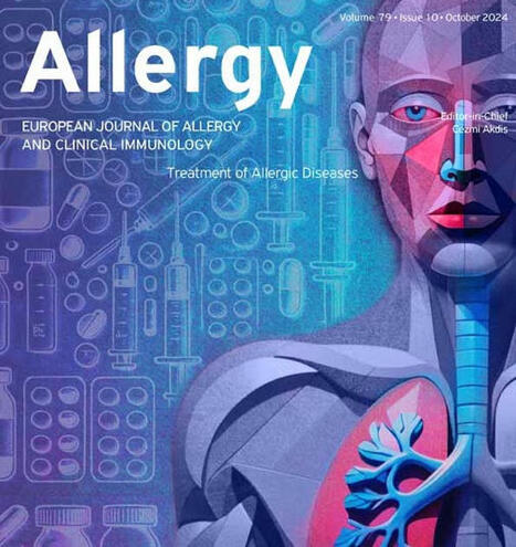 Allergy, Asthma and Immunology: How type-2 dendritic cells induce Th2 differentiation: Instruction, repression, or fostering T cell-T cell communication? | Allergy (and clinical immunology) | Scoop.it
