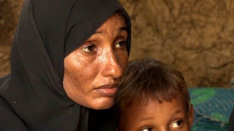 Inside #Yemen 's forgotten war - BBC reportage 10 mn  News #SaudiArabia #WarCrimes #Humanitarian | Infos en français | Scoop.it